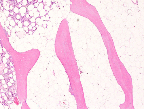Thermo Scientific: Sectioning of bone as a specialist histology specimen