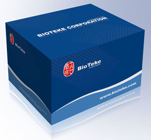 Thermo RT Kit : First Strand cDNA Synthesis Kit,BioTeke Corporation ...