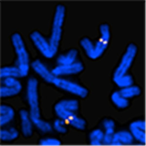 ROS1 FISH Probe,Empire Genomics_specification/price/image_Bio-Equip in ...