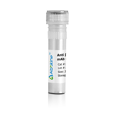 Cardiotrophin-1 Polyclonal Antibody,China/Abbkine_specification/price ...