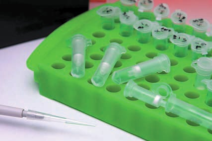 Porvair:Chromatrap® enriches epigenetic marks from primary cells