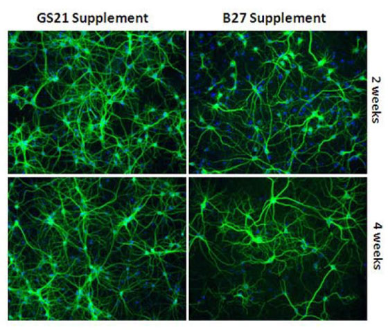 AMSBIO:Improving Overall Growth & Performance of Primary Neurons