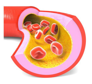 AMSBIO:Blood-Derived Products for Personalised Medicine Research