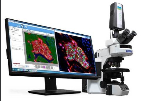 Mantra™ quantitative pathology workstation with inForm® image analysis software enables easy visualization, quantification and phenotyping of multiple types of immune cells simultaneously in intact FFPE tissue sections for cancer immunology research