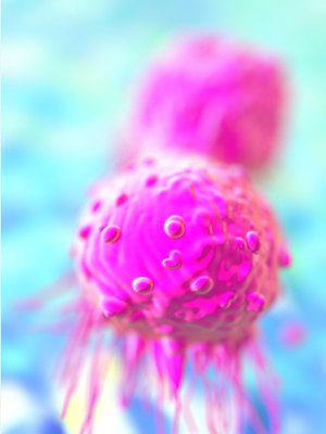 AMSBIO:Improving Accuracy, Productivity& Relevancy of Cell Based High Throughput Assays