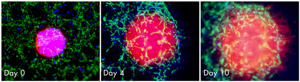AMSBIO: 3D Triculture Model for Evaluating Breast Cancer Progression