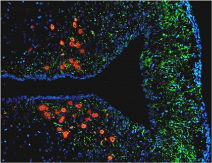 MicroMatrices staining Red = tyrosine hydroxylase, Green = leptin receptor, Blue = DAPI