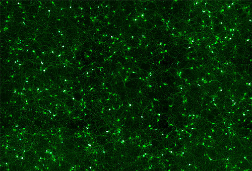 AMSBIO: Highly Efficient Neuro Transfection Reagent