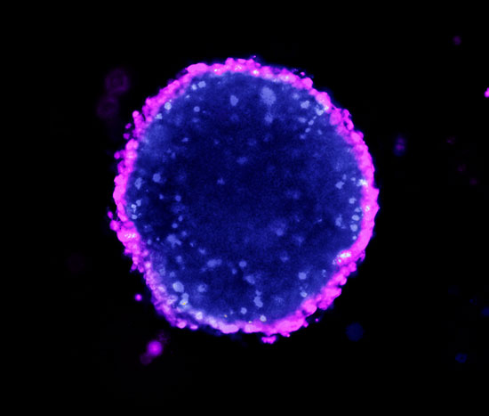 Spheroid cell culture is based on the spontaneous formation of an aggregation of cells in an environment where the interactions between cells are superior to the interactions between cells and substrate. This can be achieved by using low-adhesion cell culture conditions.
