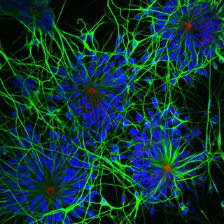 AMSBIO offers an extensive range of iPSC derived neural cells including normal and Alzheimer’s disease neural progenitor cells, and cerebral cortical neurons.