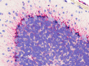 Advanced Cell Diagnostics Inc. (ACD), a leader in the field of molecular pathology and developer of cell and tissue-based analysis tools, has announced that its RNAscope® RNA in situ hybridization technology has reached two major milestones. In just three years, over 100 peer-reviewed papers featuring the technology have been published, and with the significant increase in use of RNAscope, ACD has now built a library of over 4000 target probes for numerous species.