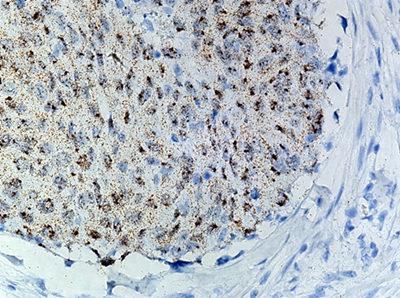 RNAscope® Technology Poised for Development as a Diagnostic Platform