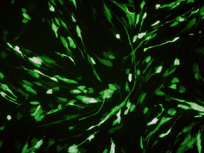 AMSBIO: Optimized CRISPR/CAS9 Delivery for Disease Model Generation