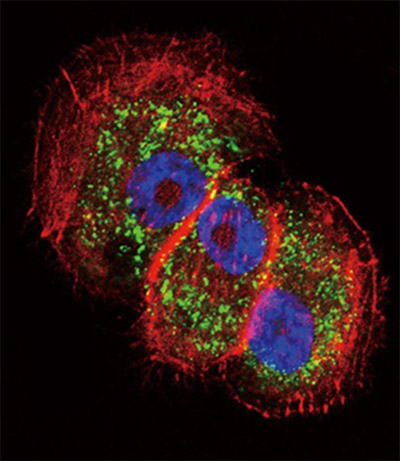 AMSBIO:Reagents for Autophagy Research