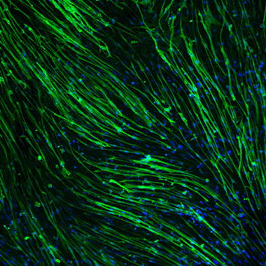 AMSBIO: Scalable Protocol to Differentiate Skeletal Muscle Cells from Stem Cells