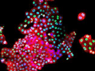 AMSBIO: Primary Human Cancer Cells