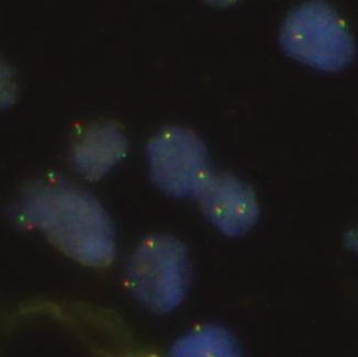 OGT Expands Cytocell FISH Probe Portfolio for Lung Cancers