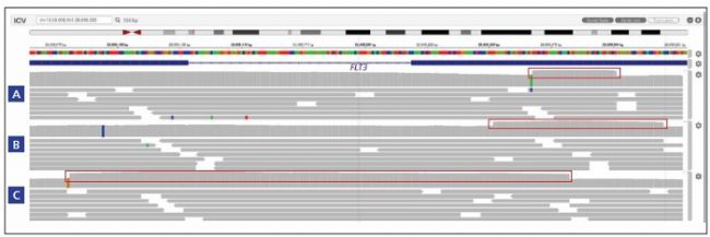 Detection of FLT3 ITDs of difference sizes
